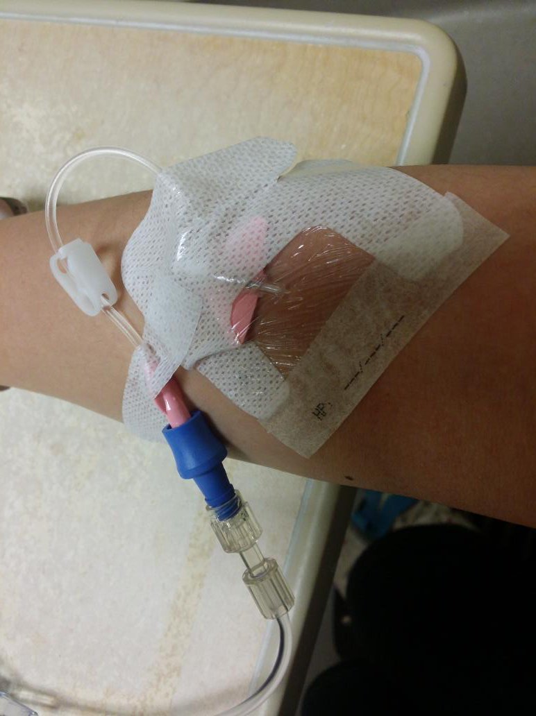 _C8C2's tweet image. #3Tries later #adultcare finally got a #LineIn #GreatCare so far! CC @DrJoshuaTepper @IrfanDhalla @DrEricHoskins