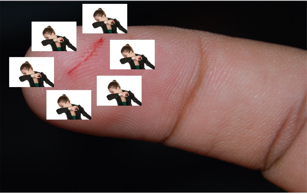 NathanZed's tweet photo. doctor: just gently dab around the wound 
me: https://t.co/495cduO8GG