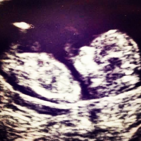 anyone else see a half grown baby with hair smoking a spliff #StarWarsTheForceAwakens  #DoGreatThings