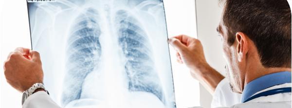 Experts warn that a recent #ecig study is misleading and could cost lives. #truth #ecignews buff.ly/1NAiJZ7