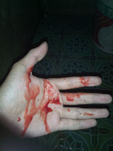 Nampaknya makin parah -_-