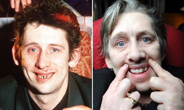 NME's tweet photo. Shane MacGowan shows off brand new set of teeth after undergoing 'Everest of dentistry' https://t.co/IWV2zpmLFB https://t.co/caguDkRuQQ