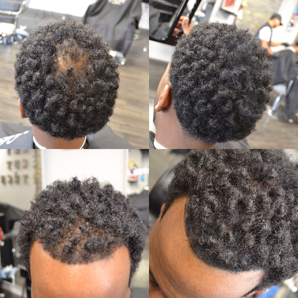 jtr568's tweet photo. Before / after natural hair fiber enhancement https://t.co/DoYmzn9Phw