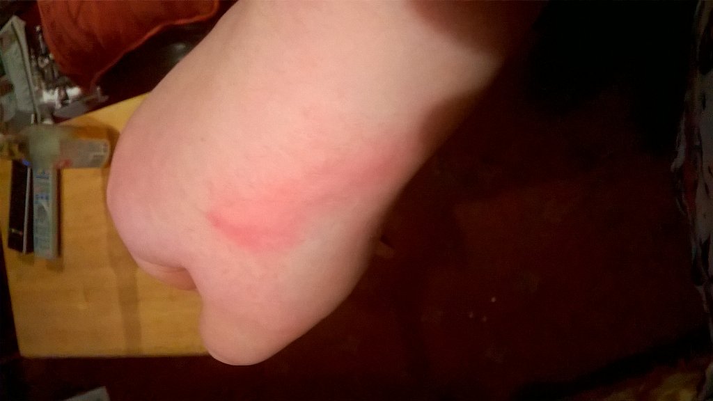 TDdaawg's tweet photo. I burned myself! 😞 https://t.co/08WGtXIqFZ