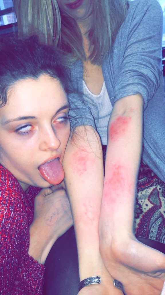 RedCherryCrew's tweet photo. Playing with makeup today!! But need some input from our fans.. Which rash is ur fav?! Let us know!!❤️ https://t.co/4UkZ6F7Hbq