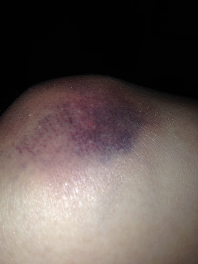 Halom1240's tweet photo. BBGs go hard. #broomball https://t.co/x9AVI7pG7e