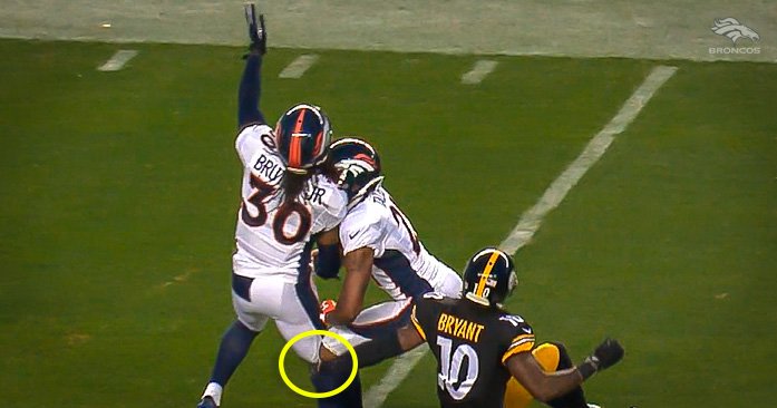 Broncos's tweet photo. There were never any questions about @D_Brut30's toughness.

THEN he played w/ a broken leg https://t.co/fkF1FoFpiG https://t.co/AYG8sczXx4