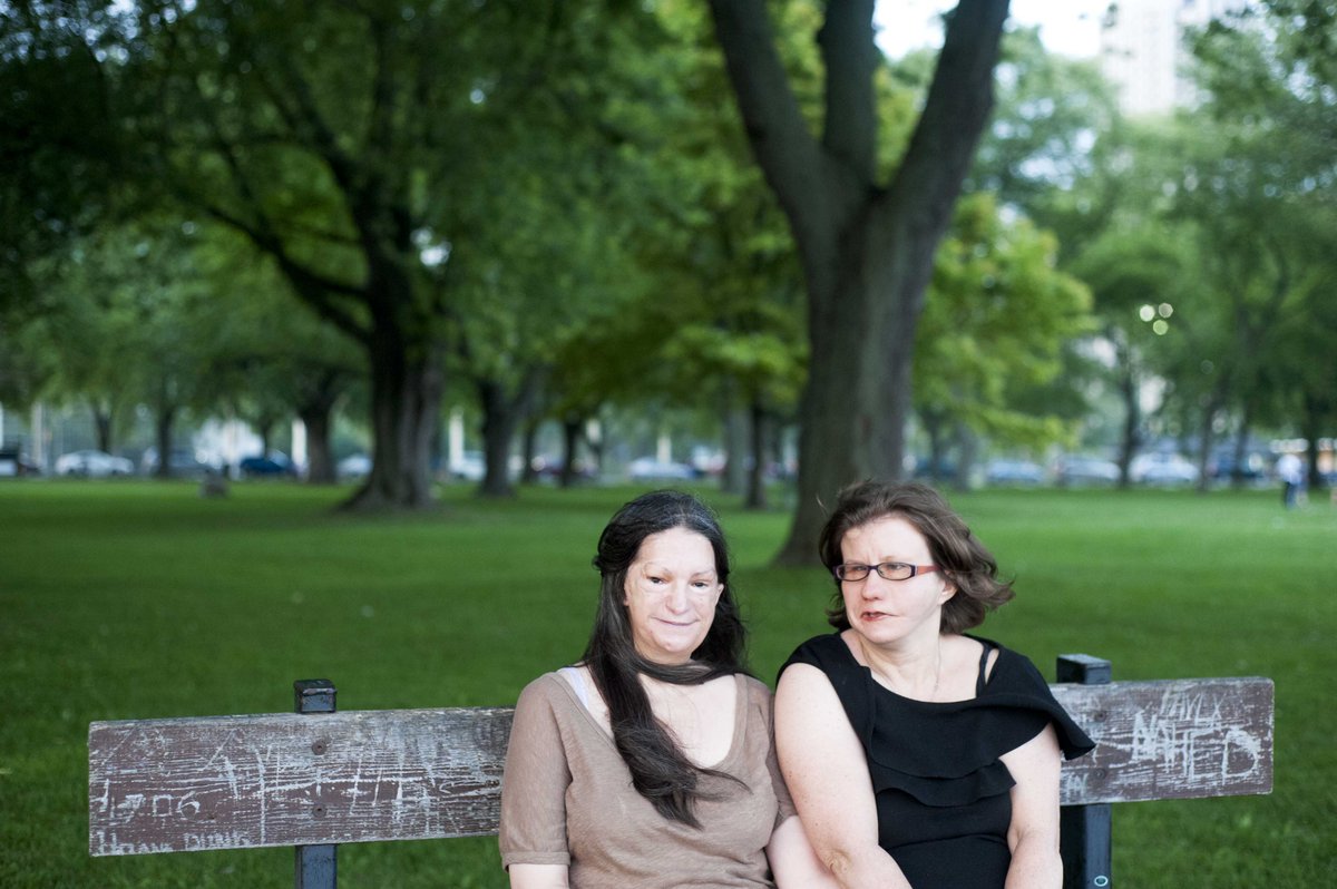 LouiseKinross's tweet image. A face is only part of the story bit.ly/1OJD04o @aboutface @TanyaWorkman @MoebiusSyndrome @pauline_beal