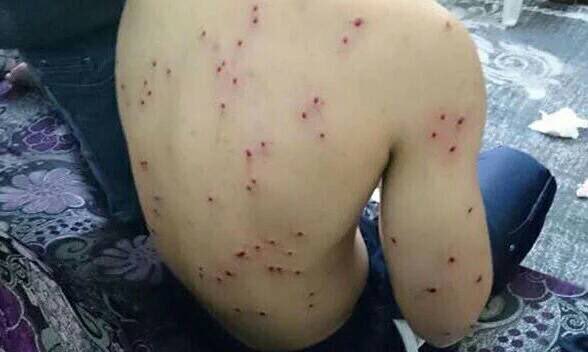SALAM_DHR's tweet photo. Use of shotgun heavily today against peaceful demonstrators in several areas in #Bahrain https://t.co/8PXGqV6qik
