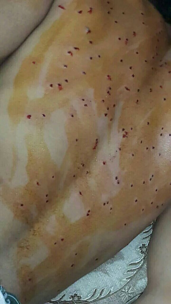 SALAM_DHR's tweet photo. Use of shotgun heavily today against peaceful demonstrators in several areas in #Bahrain https://t.co/8PXGqV6qik