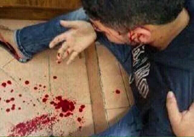 Use of shotgun heavily today against peaceful demonstrators in several areas in #Bahrain