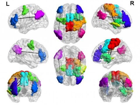 ScienceDaily's tweet photo. Brains of Compulsive Video Game Players https://t.co/O5WyoAHffb https://t.co/rIgmsQQSCN