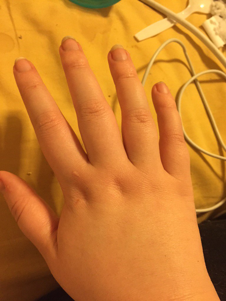 hannahmosk's tweet image. wooo #arthritisproblems