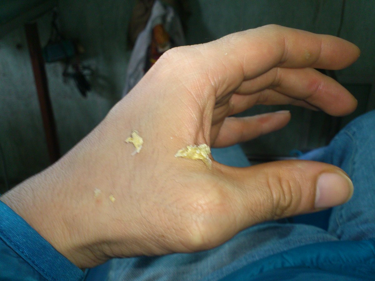 Tay Trạch Tin Chieu A Twitter もう一つダナンでやらないといけないことが散髪です あいにく今髪は短いので耳かきだけしてもらいました 耳の奥までは日本では医師でないとしてくれませんがここでは床屋でやってくれます 半年分の耳垢ｗ ドン T Co