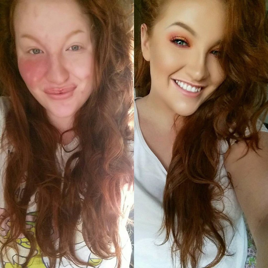 BrowsAustralia's tweet photo. The power of Makeup by @ruthdreamsxo Proud of you Ruth 💪🏻 you r so inspiring 😘 #ABH #AnastasiaBrows #BrowsAustralia https://t.co/Jiuvjqcad3