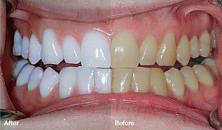 SmilesChester's tweet image. #Chester #dentist #thebest