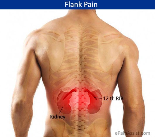 Flank Pain

epainassist.com/back-pain/lowe…

#FlankPain #BackPain #Causes #Types #Treatment #SignsandSymptoms