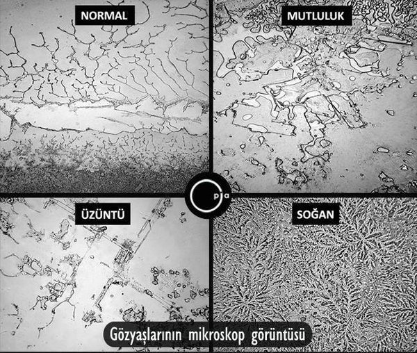 Gözyaşlarımızın mikroskop görüntüsü.