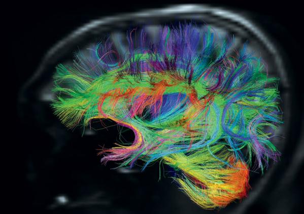 scoopstalk's tweet photo. There are more nerve connections in your brain than there are stars in the galaxy.. https://t.co/qpOBrXkKp5