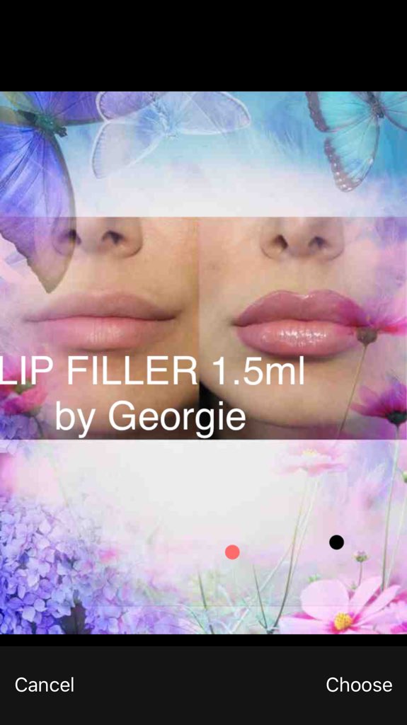LipBotox tweet picture