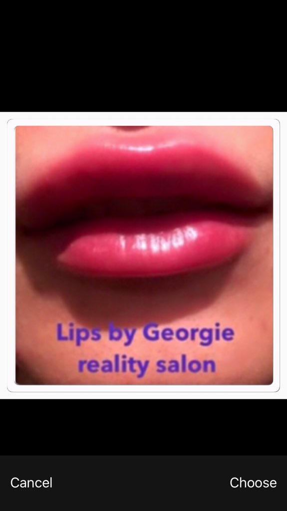 LipBotox tweet picture