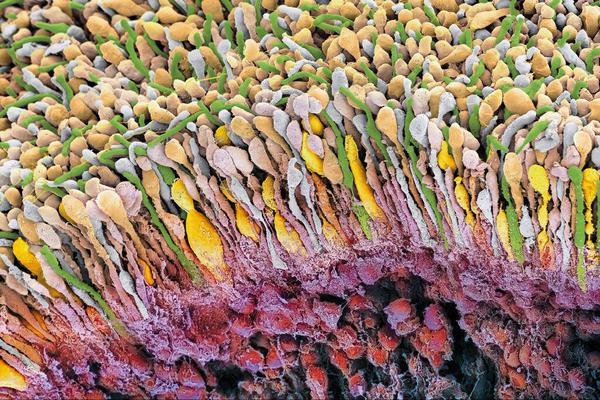 Bayer's tweet photo. A complex neural network with over 100 million #photoreceptors. This is the retina of an #eye. #BayerScience https://t.co/QNczcw5Mzr