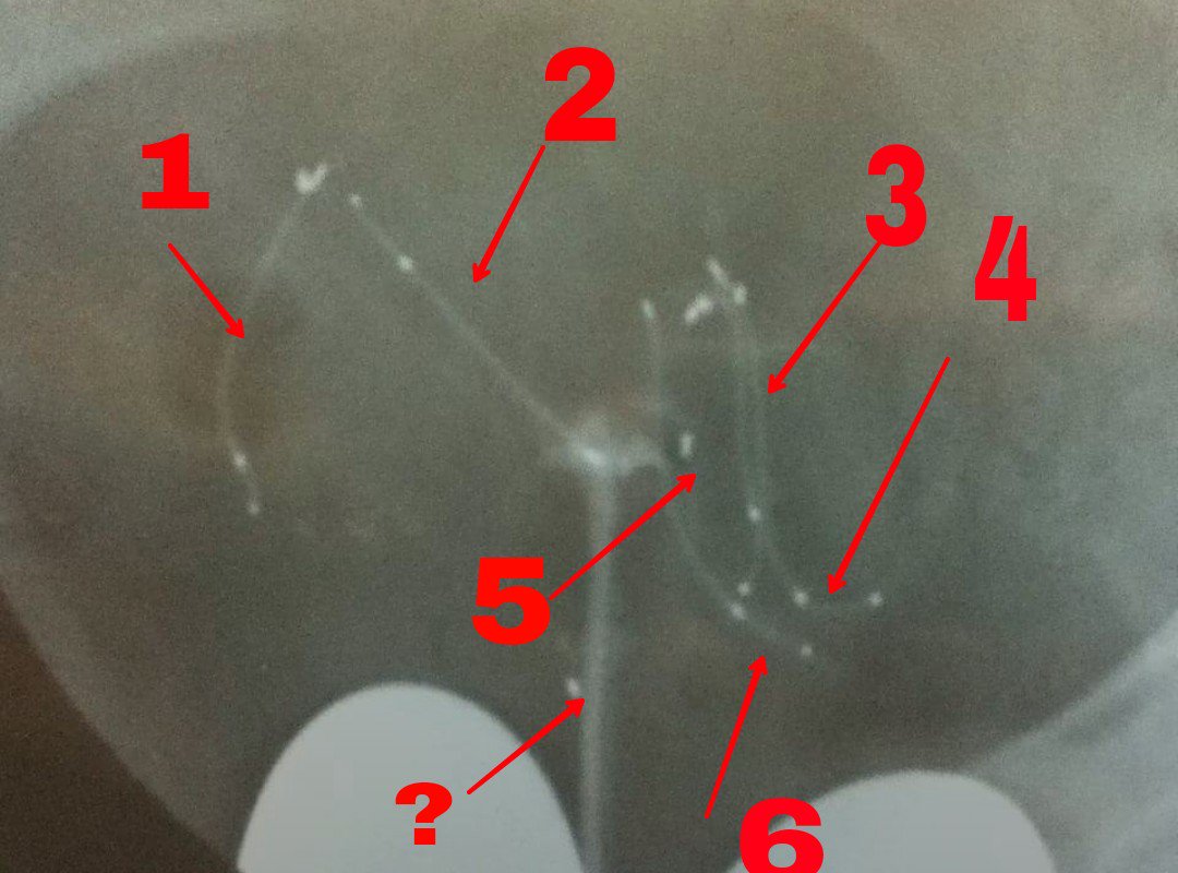 DebInColorado tweet media