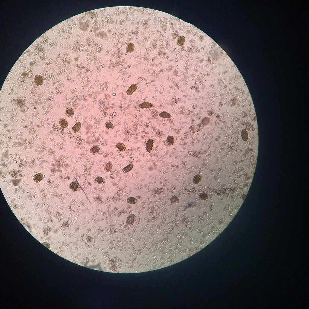 TheCaringTimes_'s tweet photo. Pool of Ascaris lumbricoides under LPF. Fertilized and Unfertilized Eggs. #Fecalysis #ClinicalMicroscopy #internshi… https://t.co/82sObytMyI