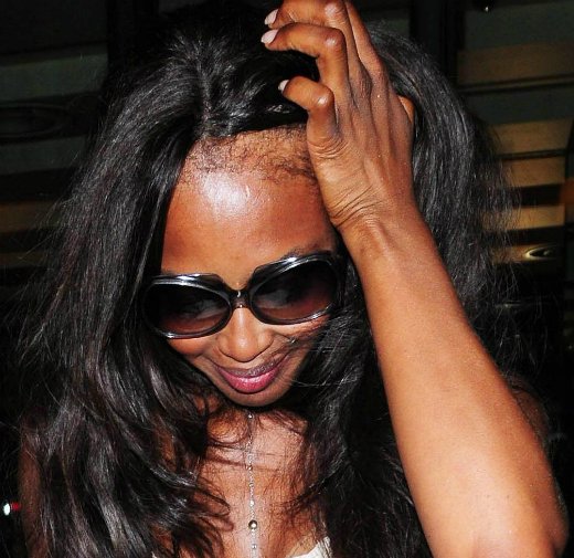 Terrible Hair Days! Worst celebrity hair extensions and weaves | Citizen TV  Kenya | Scoopnest