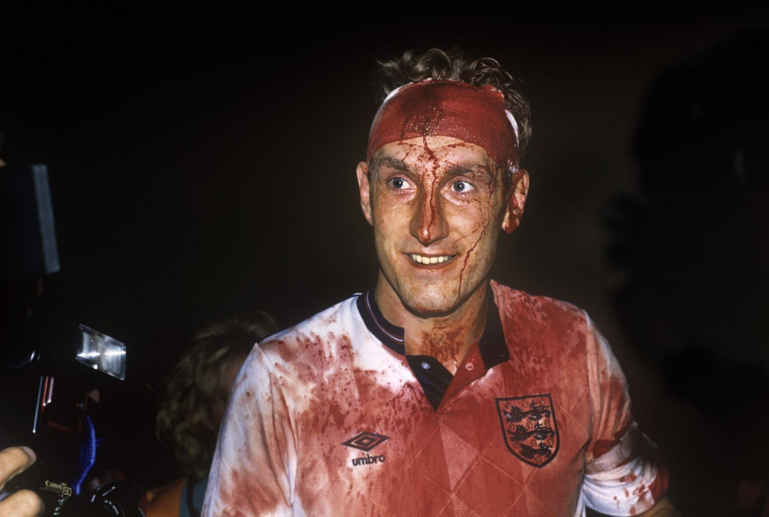 Happy 57th Birthday Terry Butcher!

\"Blood?...What blood?\" 