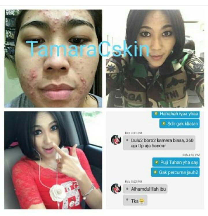 mulusdotcom's tweet image. tcskin.blogspot.com
Info order : 
bbm 5800e3f3 
WA. 08568465656