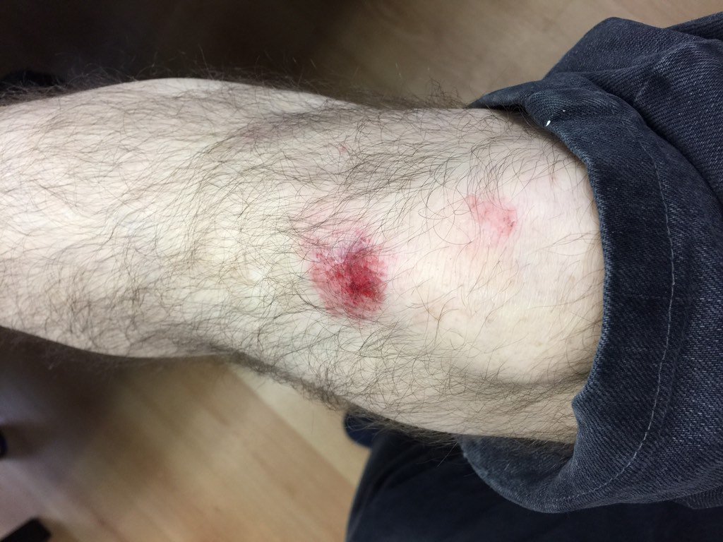 Lluvia+bici+trampillametálica de ventilación del metro=ostia+esguince+adiósvacacionesnavideñas
#graciasqueestoyvivo