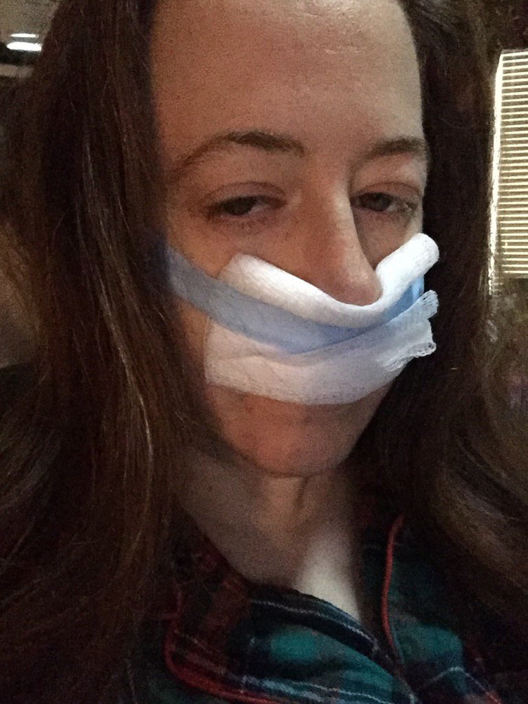 marychastain's tweet photo. Recovering. #Septoplasty #TurbinateReduction #Tubes https://t.co/JI0f9m2yQP