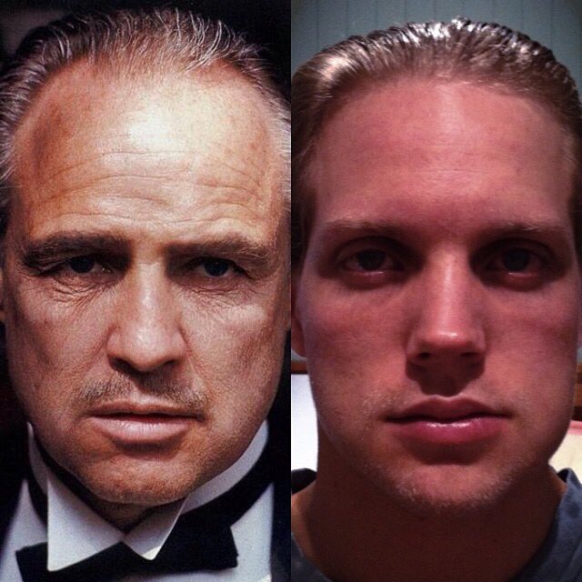 When the dentist made me an offer I couldn't refuse. #wisdomteeth #codeine