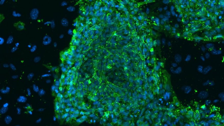 cellider's tweet image. #Stemcells help evaluate experimental #Alzheimer's drugs @UCSDnews @harvard goo.gl/CvL9eP