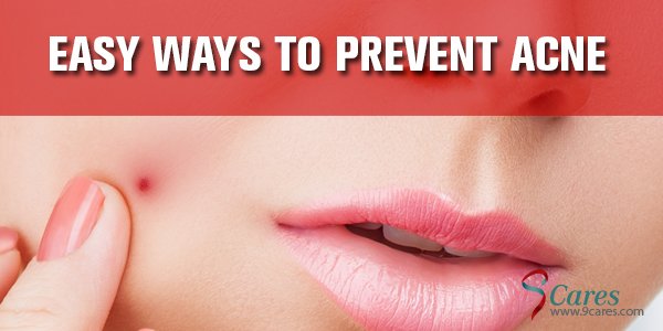 _9cares's tweet photo. Easy ways to prevent acne:  https://t.co/HwQzGnCnyZ https://t.co/SJLTMSWqrL