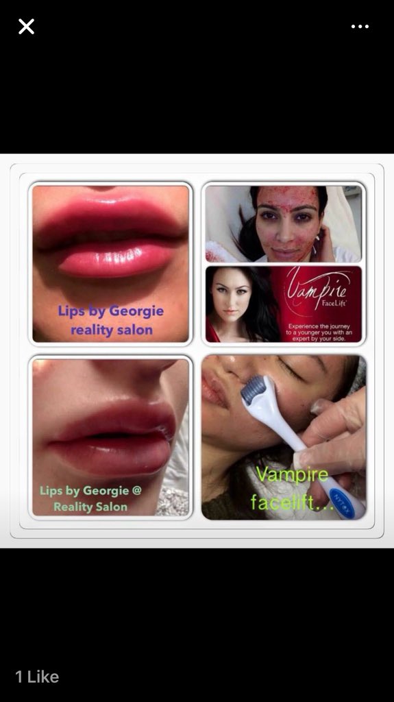 LipBotox tweet picture