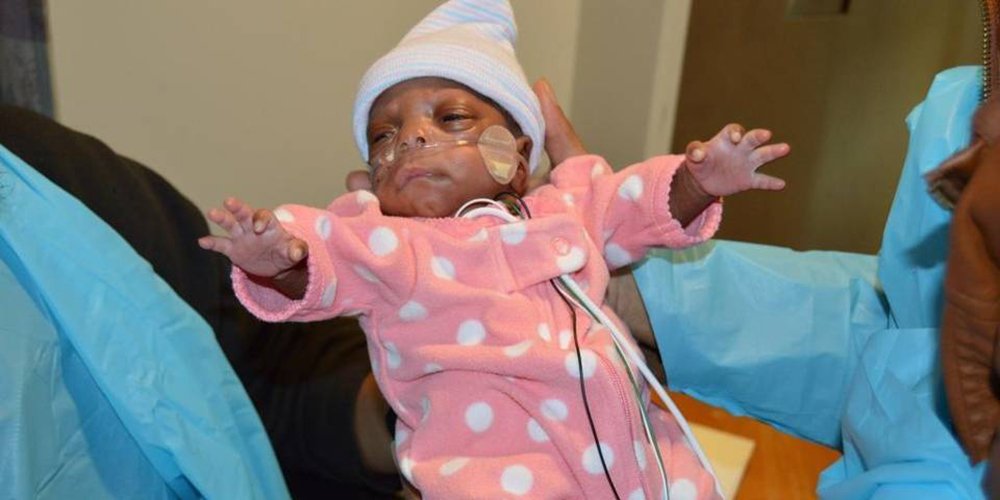 CleanersHR's tweet image. Hospital Celebrates "One of the World's Smallest Babies Ever Born" bit.ly/1IGTl7D