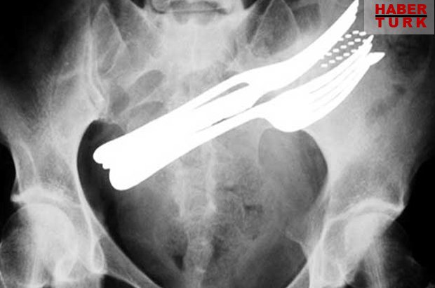 Dünyanın en korkunç röntgen çekimleri hbr.tk/Cjd09o