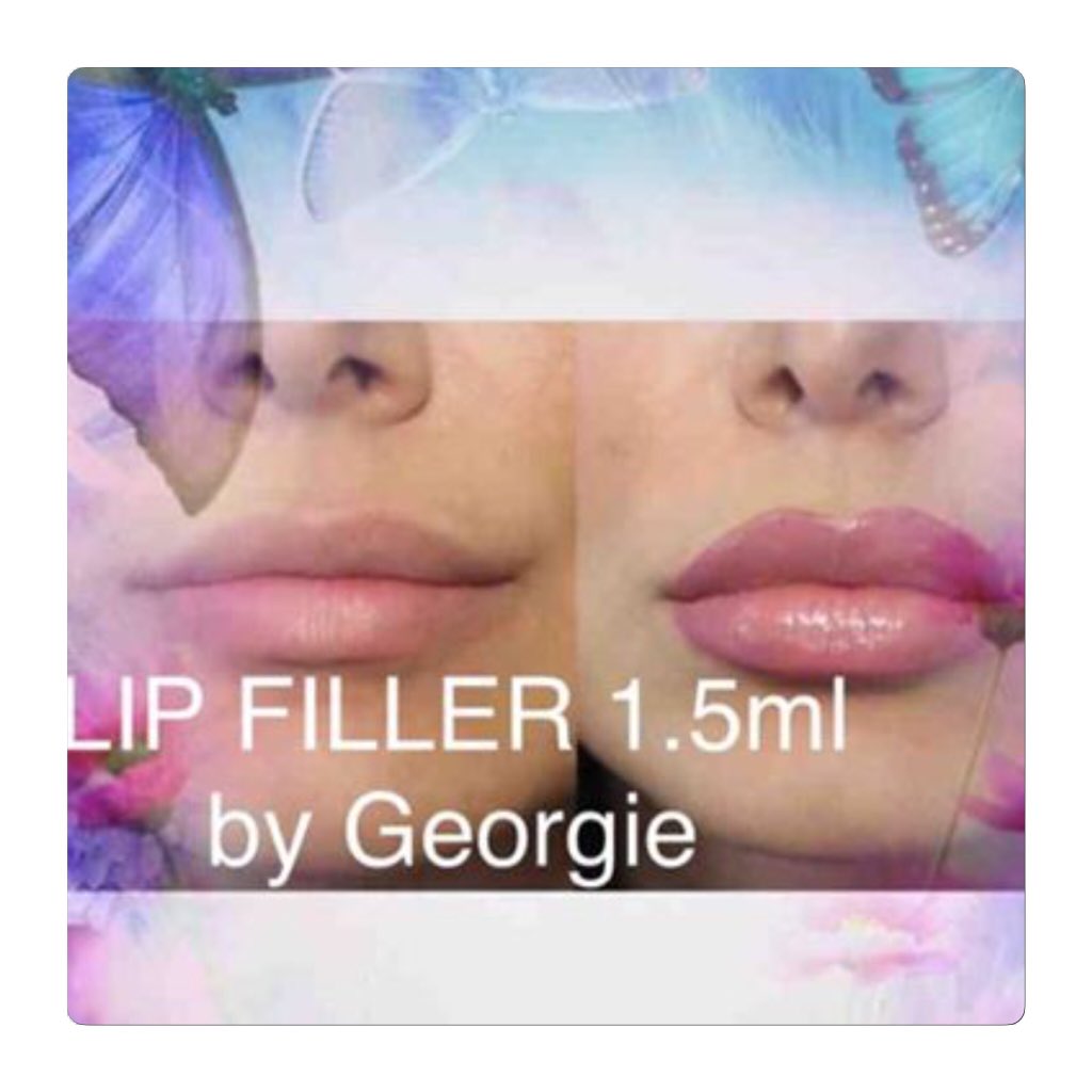 LipBotox tweet picture
