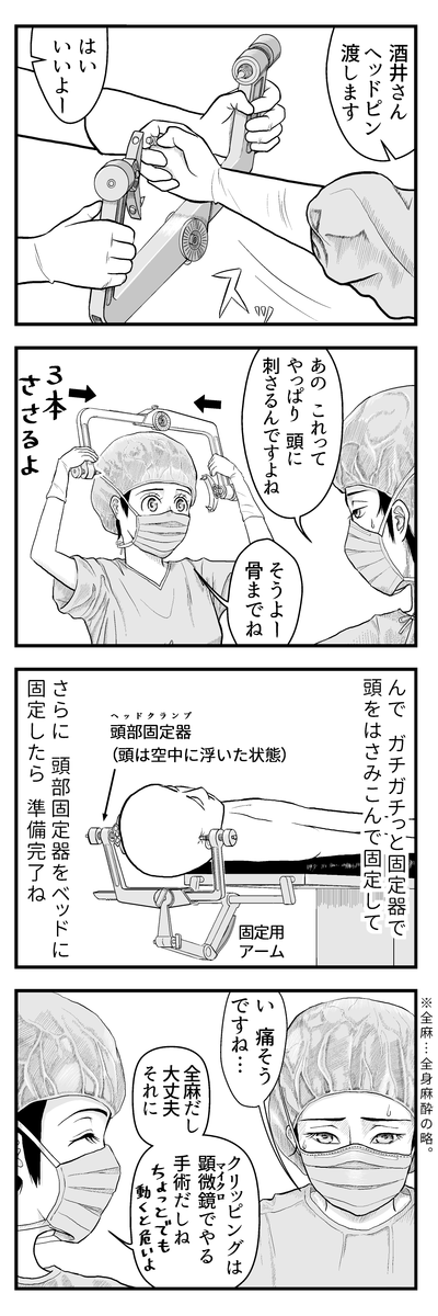 ブログ更新のお知らせ→ のうげかなう。 : 048 はじめての開頭手術② 頭部固定器 https://t.co/YbWUufQQ0N 