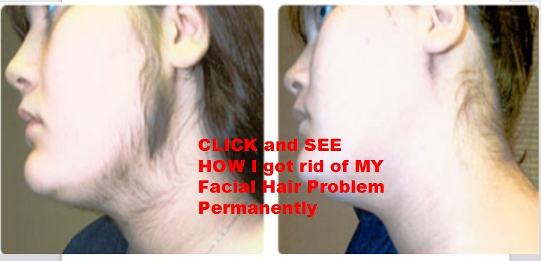 HairPermanent's tweet photo. Female Face Permanent Hair Removal #Chennai #Coimbatore #Madura #Woman #Women #beauty -->https://t.co/H8AZvdpVXY https://t.co/8hw7kkEhzF