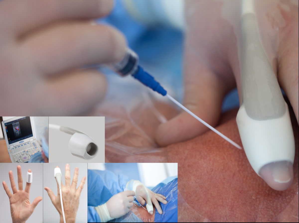 USAnesthesia's tweet photo. The future of ultrasound
SonicEye® The first wearable #ultrasound probe: intuitive, light and flexible.
#ecografia https://t.co/rnKN4qQmAe