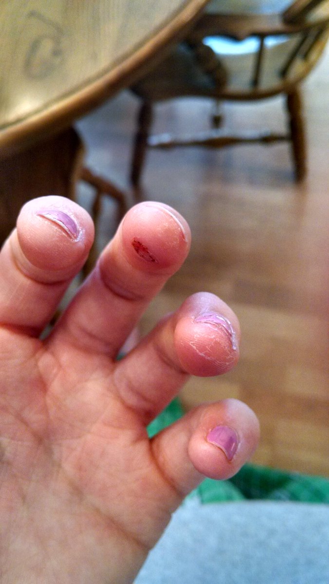 grazelle11's tweet photo. #celloprobs https://t.co/i1lLQLApIX