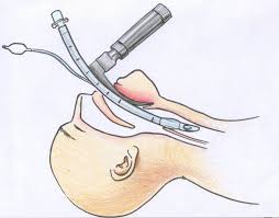 AnesthesiaClub tweet picture
