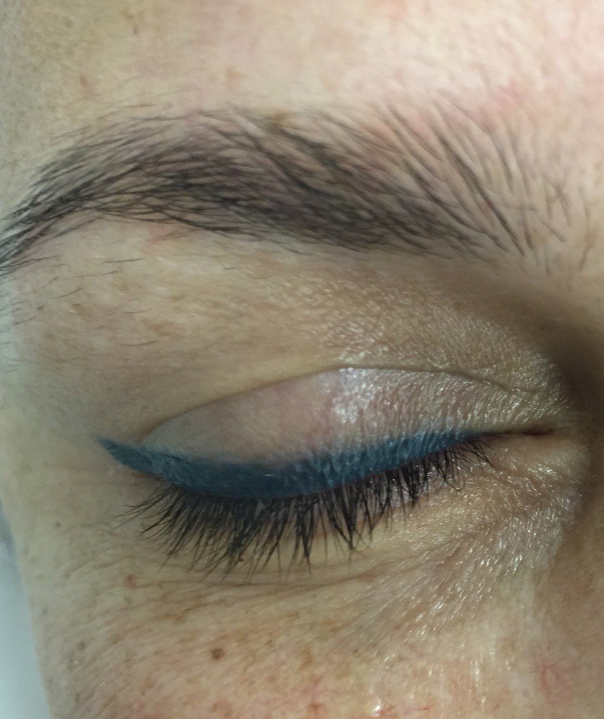 LondonLashNBrow's tweet photo. Before https://t.co/a6wObhkv2u