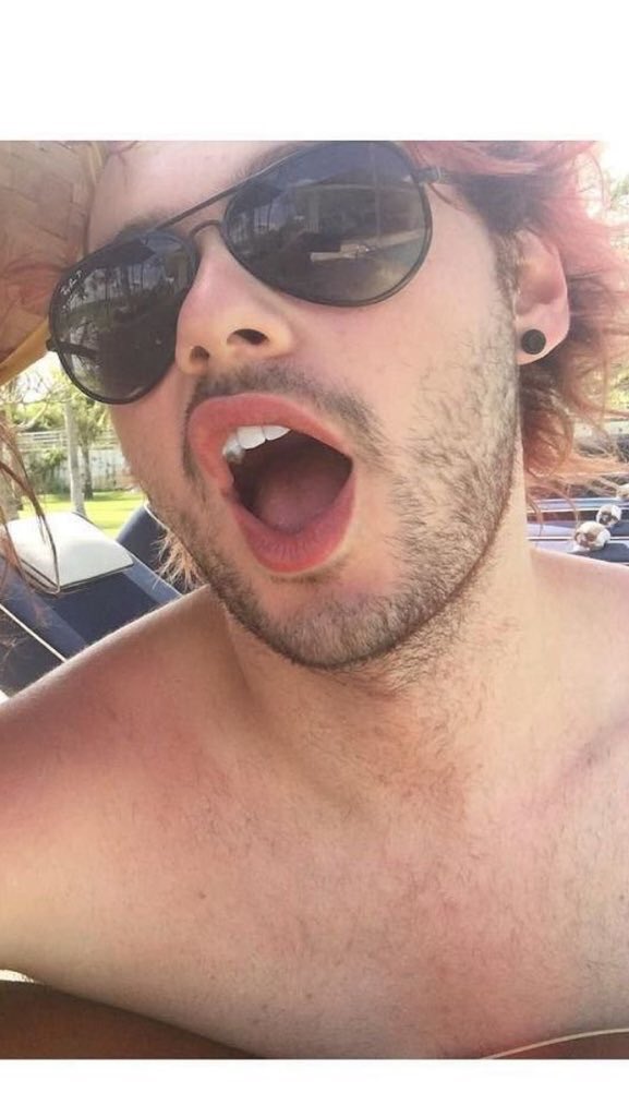 dontpanakin's tweet photo. burnt shoulders https://t.co/ck1Cihm4Tg