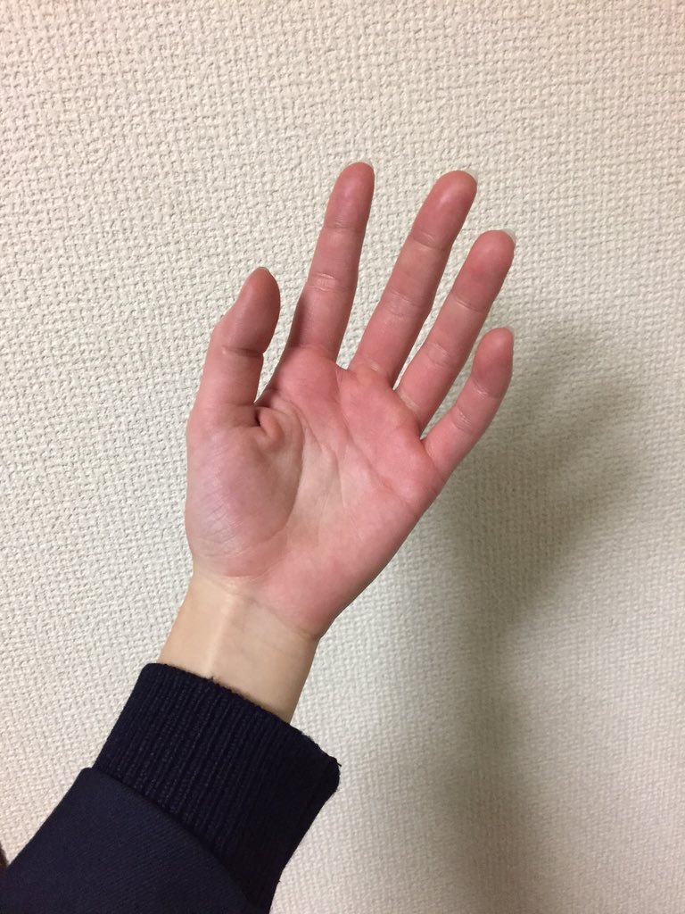 Ramu On Twitter 外から帰ってきたらこれ 寒すぎて笑っちゃうくらい手が真っ赤 寒いと手がパンパンに腫れちゃうんだけどなんなの 曲げられない W Https T Co Nilonjofda Twitter
