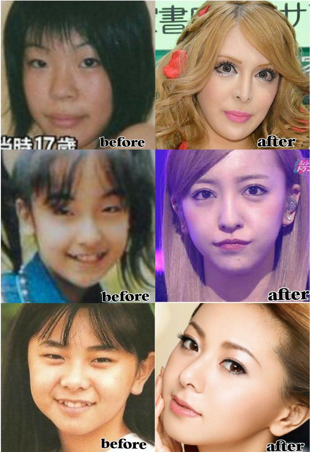 Aikoku 女性芸能人 整形前 整形後 同じ美容外科で手術してる子達は同じような顔になる T Co Kqeubuqp33 Twitter
