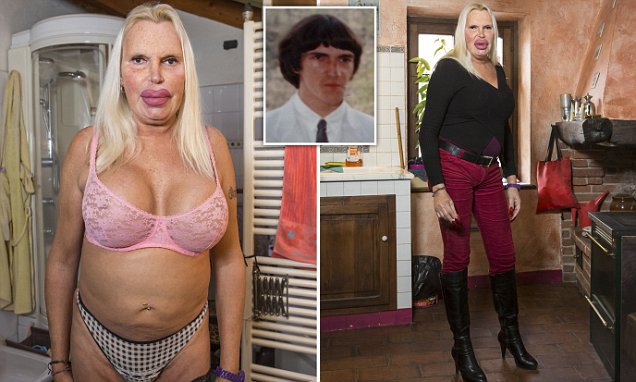 Transgender Surgery Addict Spends £52 000 In Her Quest To Have Th